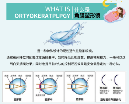 高度近视及青少年近视防控治疗全方案