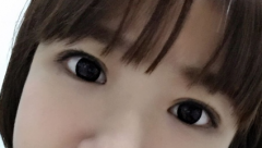 重睑术后护理事项