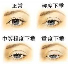 手术后应该如何观察和护理？